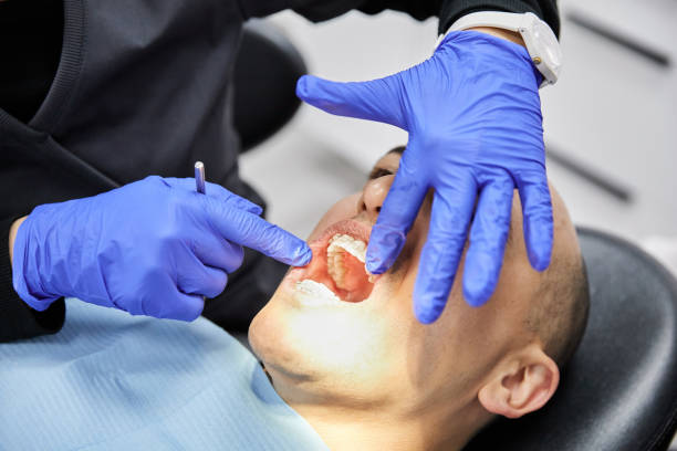 Best Emergency Dental Care for Broken or Chipped Teeth in West Lawn, PA